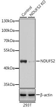 [KO Validated] NDUFS2 Rabbit polyclonal antibody