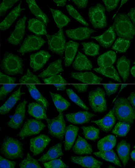[KO Validated] NDUFS2 Rabbit polyclonal antibody