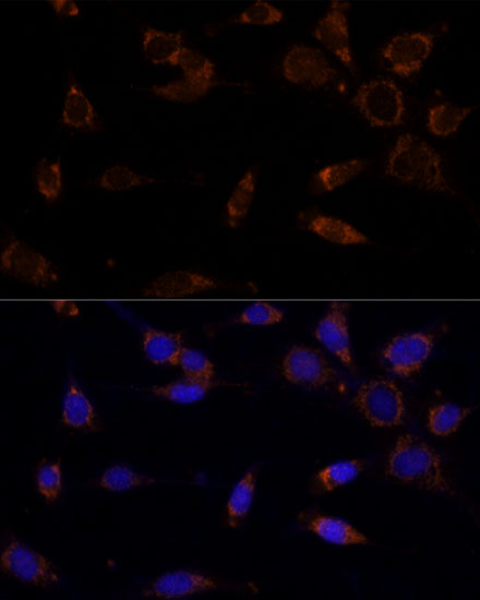 [KO Validated] MTCH2 Rabbit polyclonal antibody