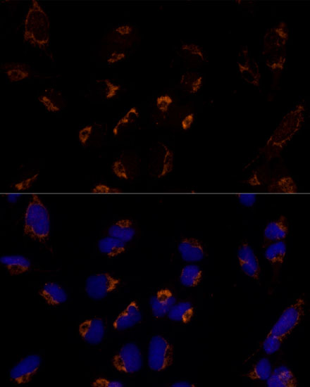[KO Validated] MTCH2 Rabbit polyclonal antibody