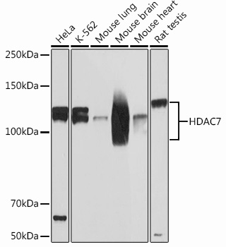 HDAC7 Rabbit mAb