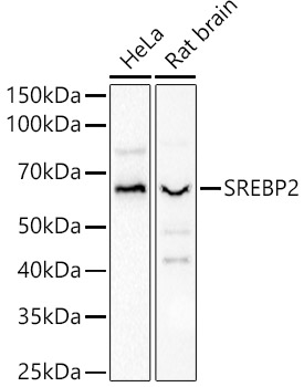 SREBP2 Rabbit polyclonal antibody