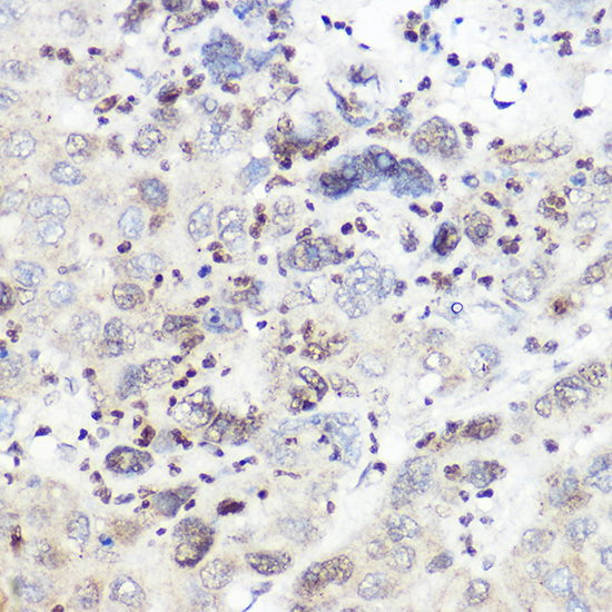 SREBP2 Rabbit polyclonal antibody
