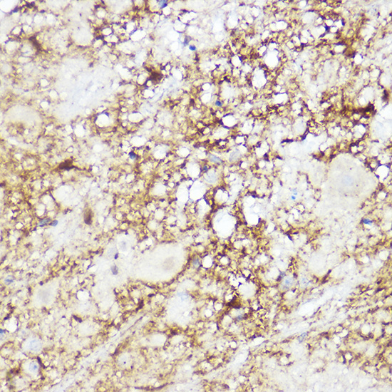 SREBP2 Rabbit polyclonal antibody