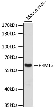 [KO Validated] PRMT3 Rabbit polyclonal antibody