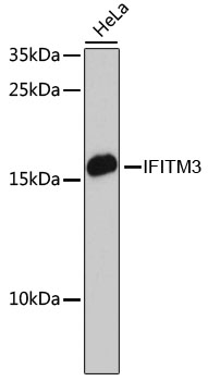 [KO Validated] IFITM3 Rabbit polyclonal antibody