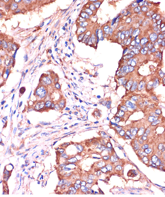 [KO Validated] IFITM3 Rabbit polyclonal antibody