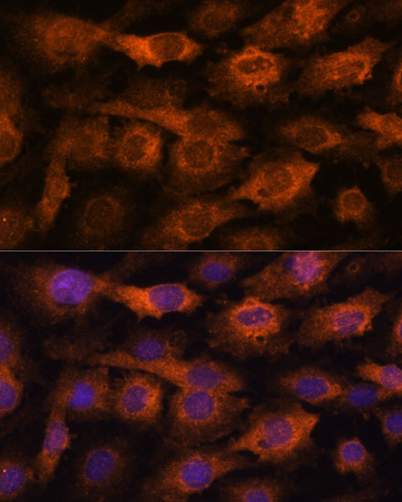 [KO Validated] IFITM3 Rabbit polyclonal antibody