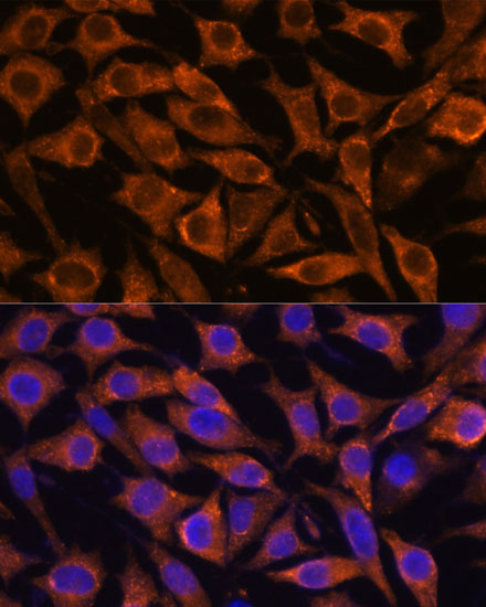 [KO Validated] IFITM3 Rabbit polyclonal antibody