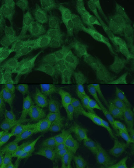 [KO Validated] IDH1 Rabbit polyclonal antibody