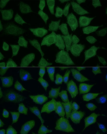 [KO Validated] IDH1 Rabbit polyclonal antibody