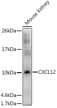 CXCL12 Rabbit polyclonal antibody