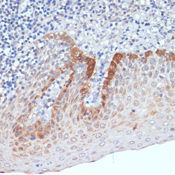 CXCL12 Rabbit polyclonal antibody
