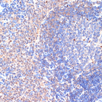 CXCL12 Rabbit polyclonal antibody