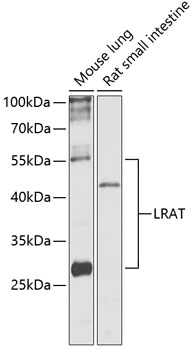 LRAT Rabbit polyclonal antibody