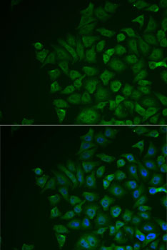 LRAT Rabbit polyclonal antibody