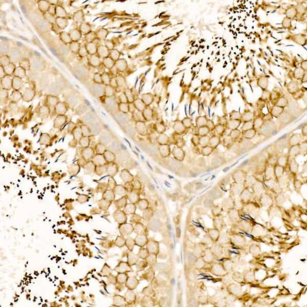 GPX4 Rabbit polyclonal antibody
