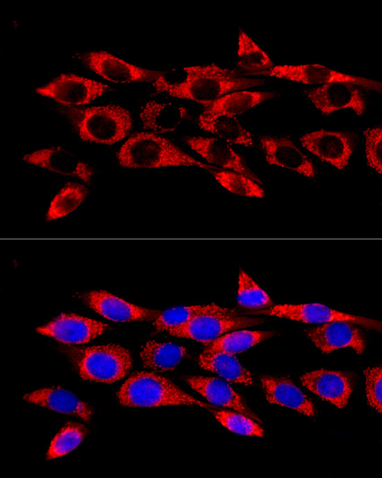 GPX4 Rabbit polyclonal antibody