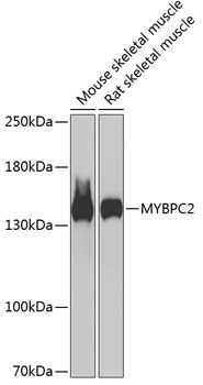 MYBPC2 Rabbit pAb