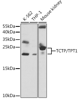 TCTP/TPT1 Rabbit pAb