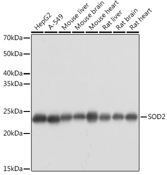 [KO Validated] SOD2 Rabbit polyclonal antibody