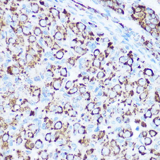 [KO Validated] SOD2 Rabbit polyclonal antibody