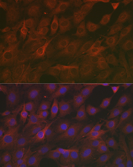 [KO Validated] SOD2 Rabbit polyclonal antibody