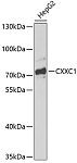 Western blot - CXXC1 Rabbit pAb (A13424)