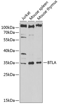 BTLA Rabbit pAb