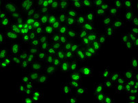 Immunofluorescence - LHX8 Rabbit pAb (A13455)