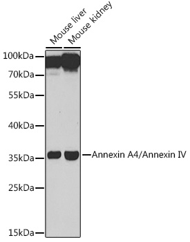 Annexin A4/Annexin IV Rabbit pAb
