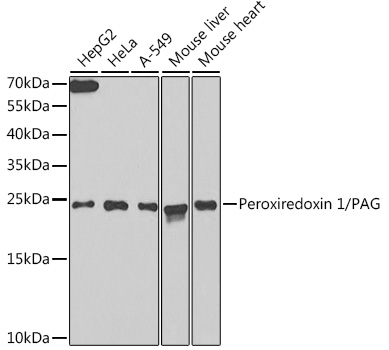 SMAD6 antibody