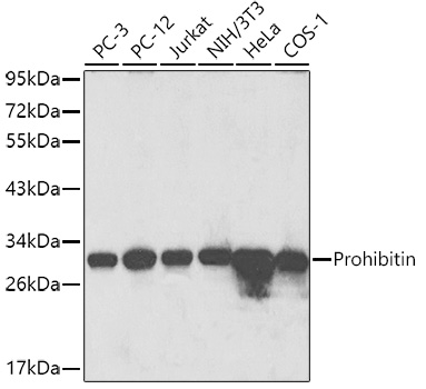 MAX antibody