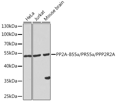HDGF antibody