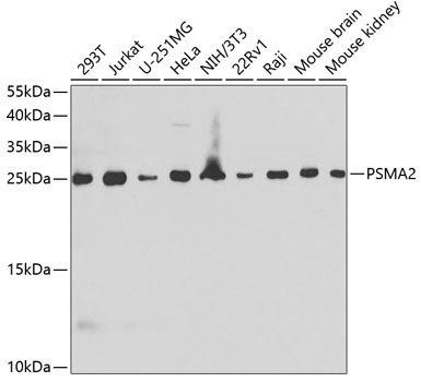 LAMP2 antibody