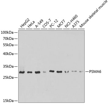 DYRK1A antibody