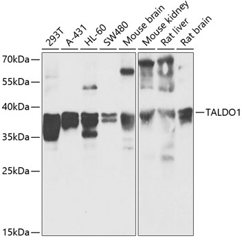 TALDO1 Rabbit pAb