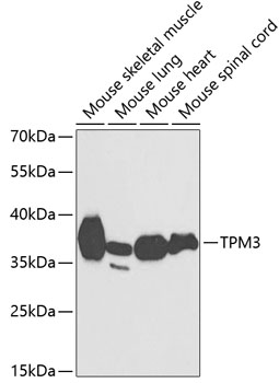 TPM3 Rabbit pAb