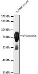 Western blot - Vitronectin Rabbit pAb (A13561)