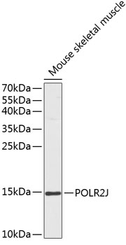 TGFBR1 antibody