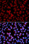 Immunofluorescence - TNFAIP3 Rabbit pAb (A13637)