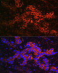 Immunofluorescence - Ceruloplasmin Rabbit pAb (A13660)