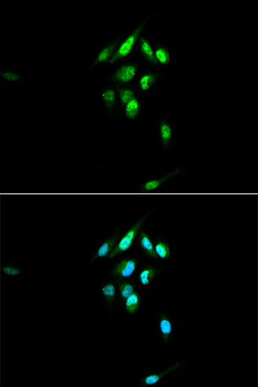 Glucocorticoid Receptor Rabbit pAb