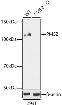 [KO Validated] PMS2 Rabbit polyclonal antibody