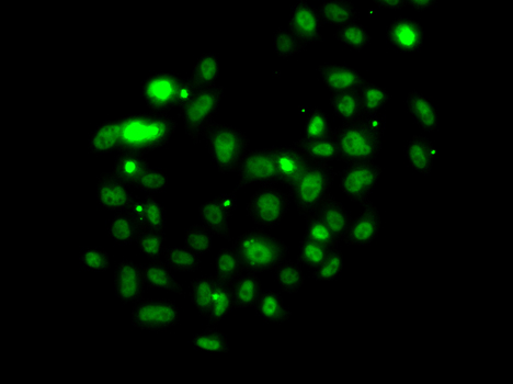 [KO Validated] PMS2 Rabbit polyclonal antibody