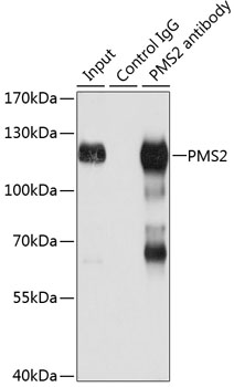 [KO Validated] PMS2 Rabbit polyclonal antibody