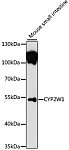 Western blot - CYP2W1 Rabbit pAb (A13762)