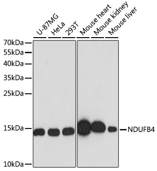 [KO Validated] NDUFB4 Rabbit polyclonal antibody