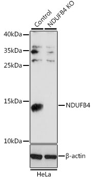 [KO Validated] NDUFB4 Rabbit polyclonal antibody