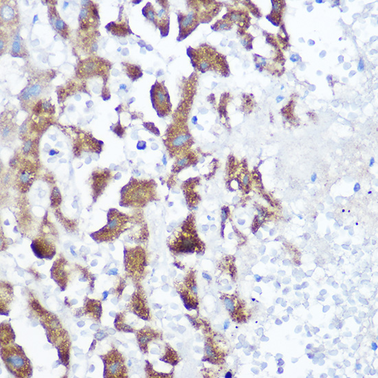 [KO Validated] NDUFB4 Rabbit polyclonal antibody